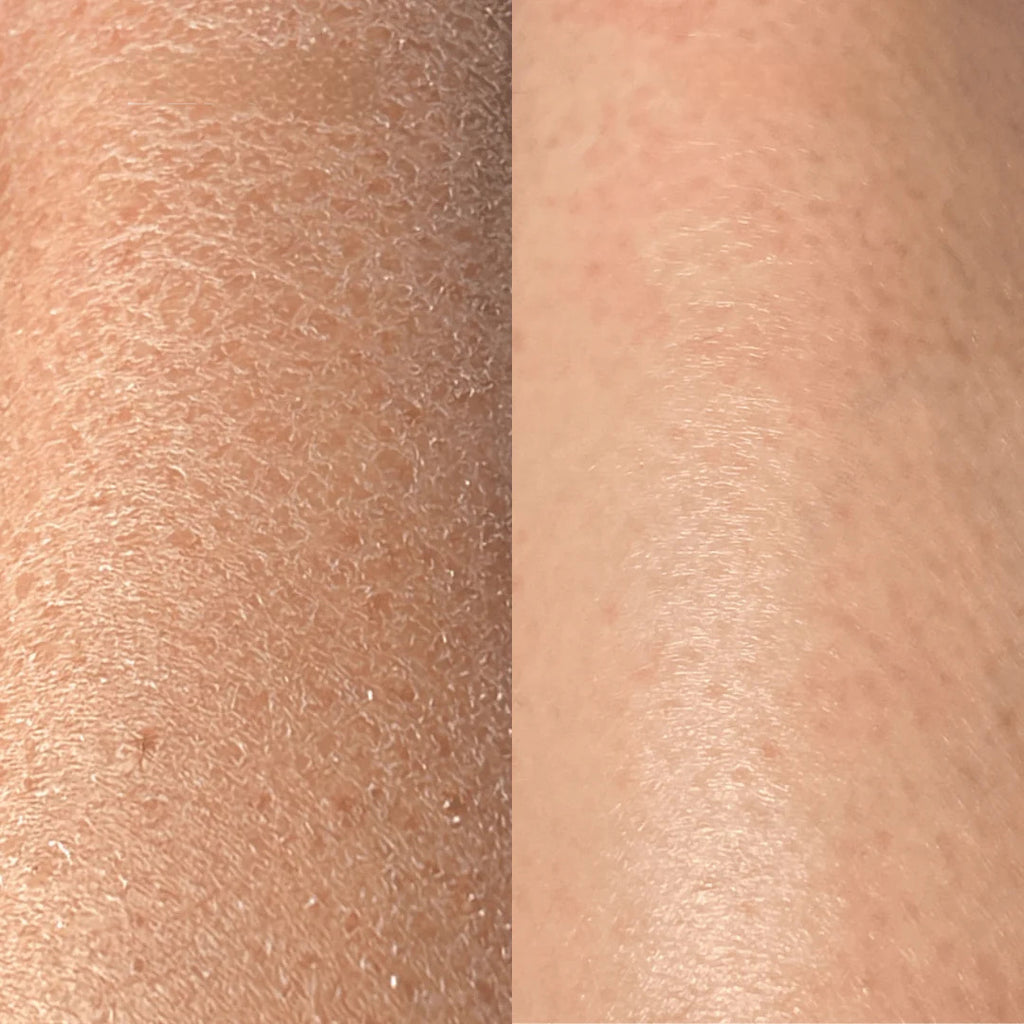 GANT EXFOLIANT DYREM