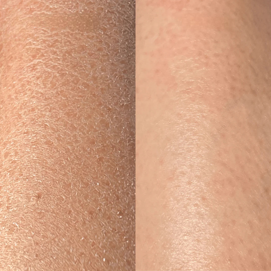 GANT EXFOLIANT DYREM