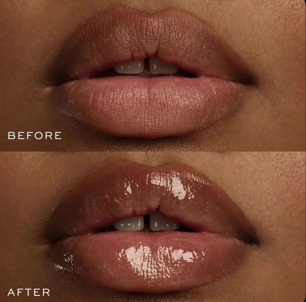 DYREM LIP – BOOST MOI