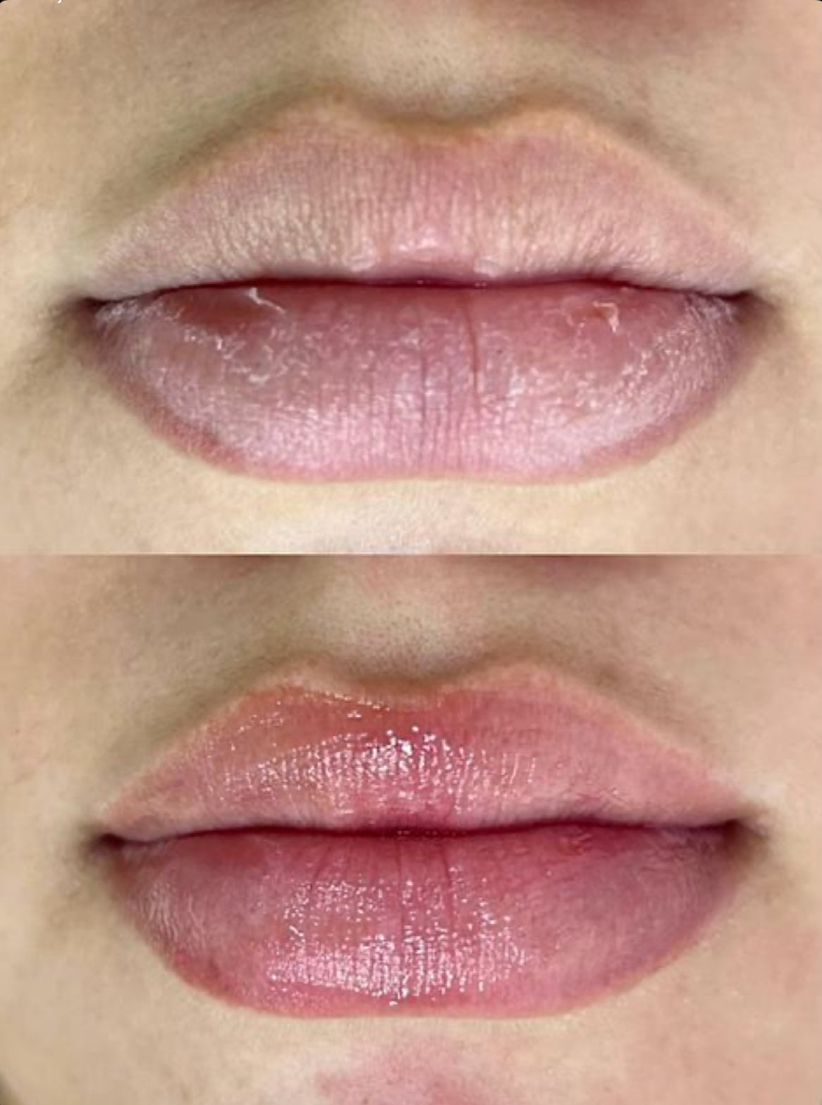 DYREM LIP – CARE MOI